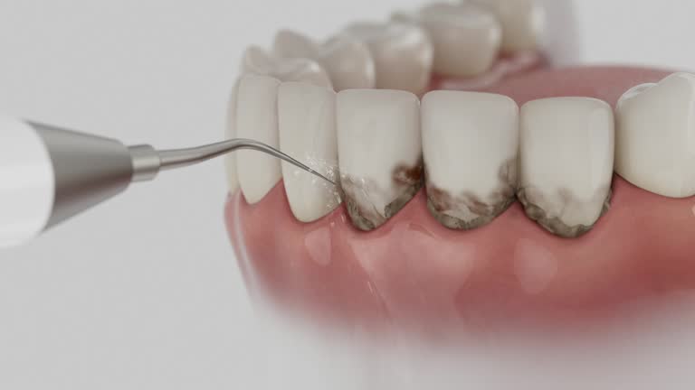 Reliable Tooth Extraction contractor in DeWitt, MI by Smile Center Dentistry